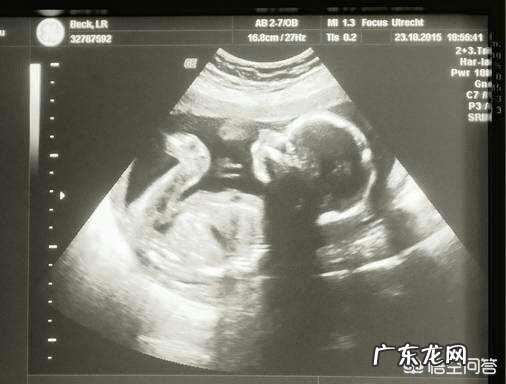 胎儿大小的判断标准是什么?