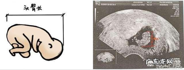 胎儿大小的判断标准是什么?