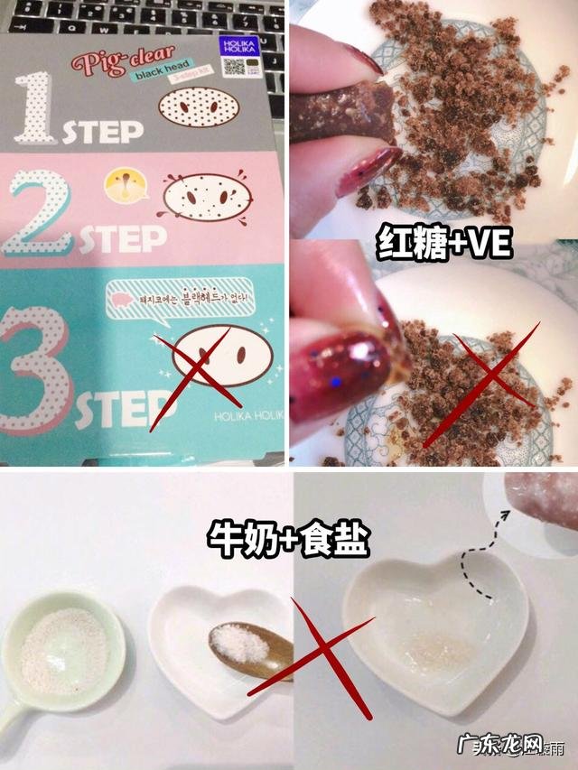 28岁，混油皮肤，额头鼻子下巴爱出油，毛孔粗大黑头，又长痘？