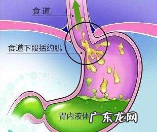 慢性咽炎,喉咙有异物感,吐不出咽不下怎么办?