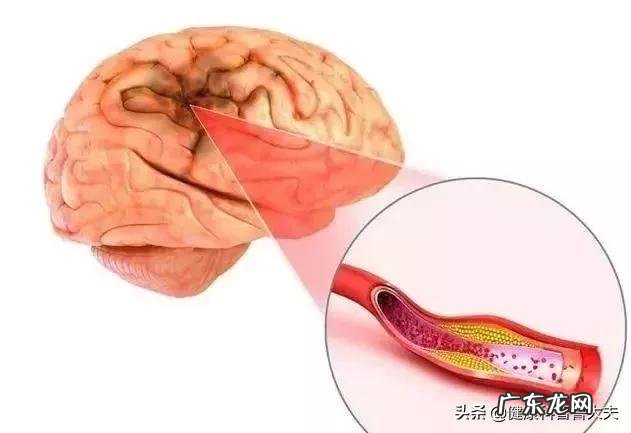 疫情期间,长了那么多肉,甩不掉了怎么办,谁有妙计安我心?