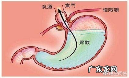 为什么吃一点点东西就胃酸?该怎么缓解?