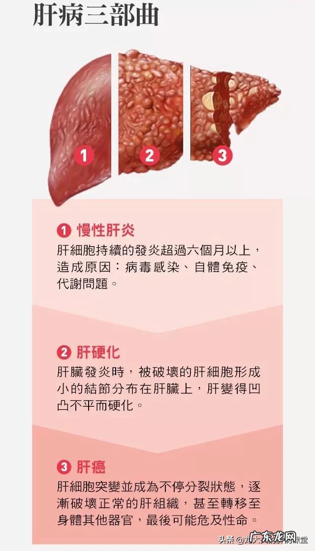 肝炎,肝腹水,肝癌有什么区别和联系