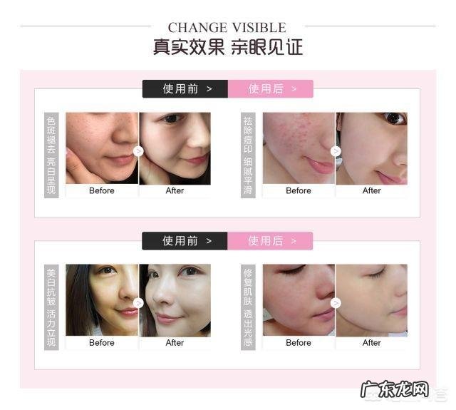 详解三七粉怎样吃可以祛斑?吃多久才有效果的祛斑小秘方?