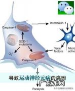 造成运动神经元病的病因有什么？