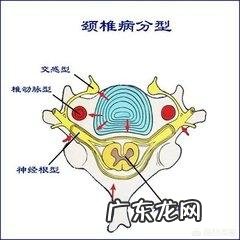 颈椎病瑜伽操12种步骤?