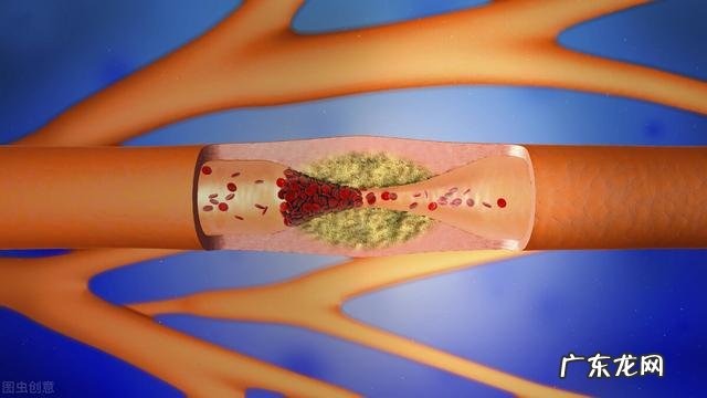 十大抗衰老抗氧食物有用吗