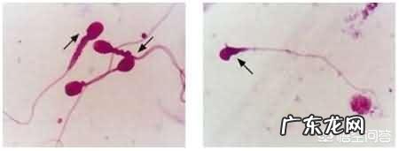 看自己是否能生育,要做哪些检查?