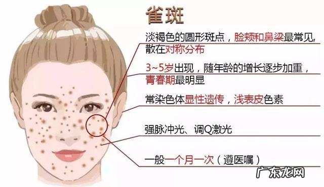 38岁女人很多黄褐斑,怎么去脸上的黄褐斑有效?