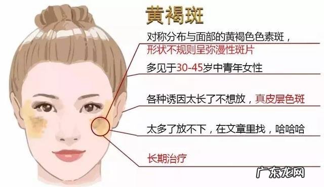 38岁女人很多黄褐斑,怎么去脸上的黄褐斑有效?