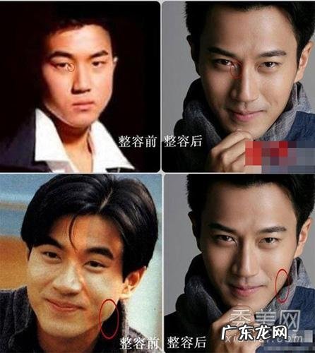 整容以后变好看的男明星有哪些?