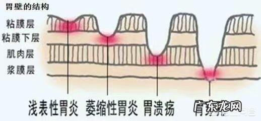 肠胃不好的瘦子如何在一个月里快速增肥?