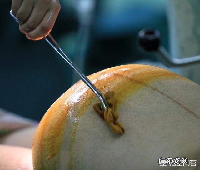 剖腹产如何科学护理伤口,可以恢复的快?