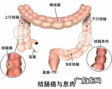肠胃功能紊乱大便会变细吗？