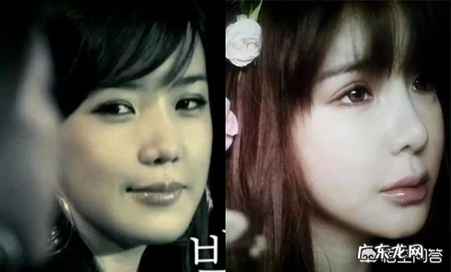 朴春整过容么？为什么她公开的近照会变成这样？