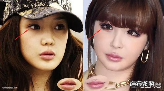 朴春整过容么？为什么她公开的近照会变成这样？