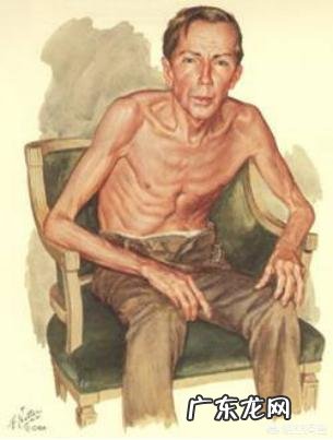 慢阻肺患者一般都伴有营养不良,慢阻肺是否与营养不良有关系?