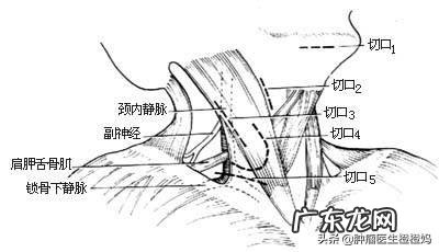 鼻咽癌是什么，该怎么防zhi？ 鼻咽癌的防zhi措施