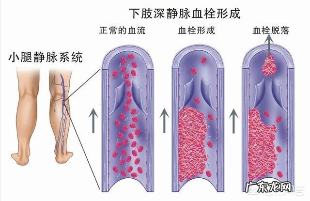 牛喂盐喂多了是不是翻毛啊