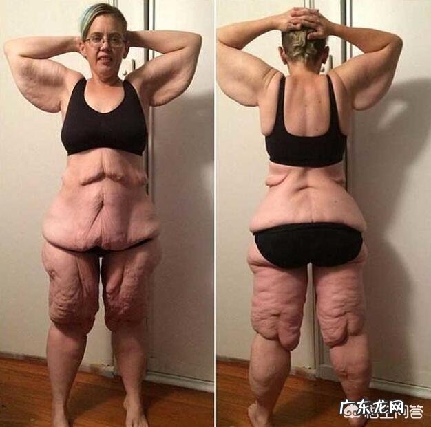 肥胖真的会很不健康吗?究竟会有多可怕?