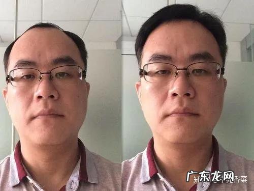 90后的女生都用什么抗衰产品？