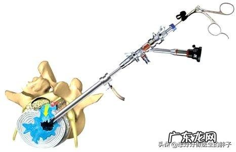 腰、腿不痛，但腿软、凉、麻是啥原因？怎么办？