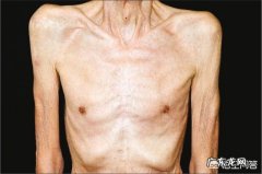 跑步减肥多久才能看到效果