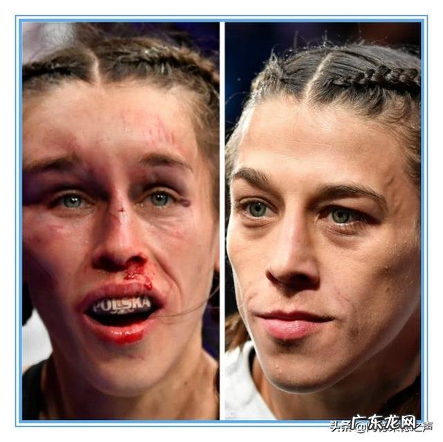 卫冕了UFC冠军,张伟丽的商业价值能够超过邹市明吗