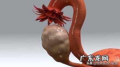 子宫肌瘤吃药可以zhi疗痊愈吗？