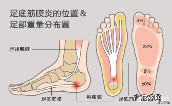 脚后跟疼，不红不肿，没有外伤没有内伤，这是怎么了？