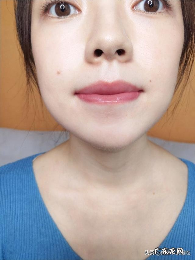 我脸上总长闭口小疙瘩怎么办?要用什么洗脸才能除掉?