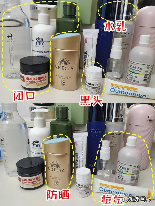 我脸上总长闭口小疙瘩怎么办?要用什么洗脸才能除掉?