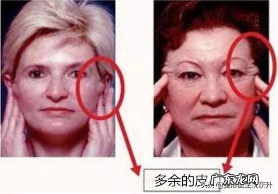 法令纹太深显老态，怎么做才能抵抗法令纹？