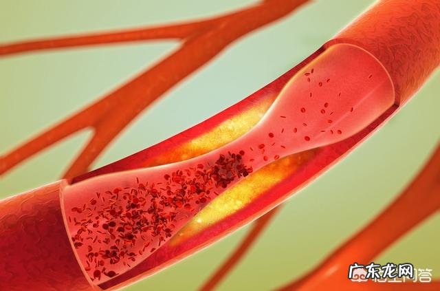 血糖高的人吃什么主食比较好?