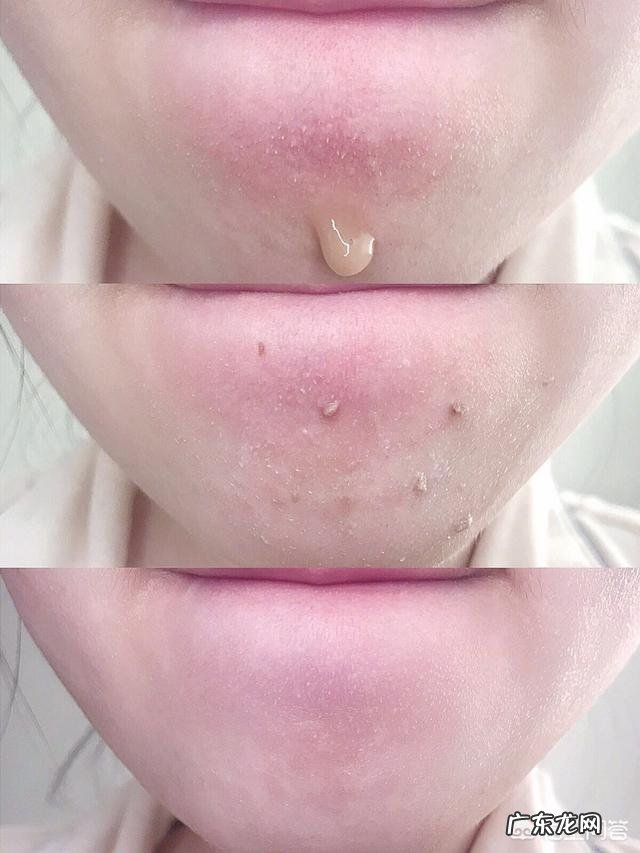 女生面部去角质产品哪个好用?