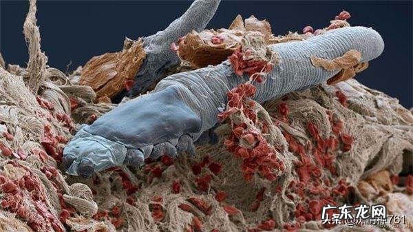 为什么天天洗头，头发还是很油腻？