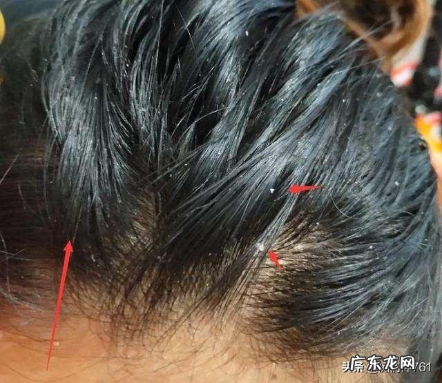 为什么天天洗头，头发还是很油腻？