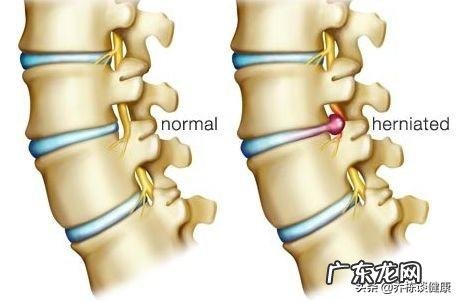 为什么跑完步之后小腿觉得涨,还有点胀痛感觉,应该如何缓解?