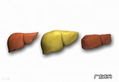 脂肪肝的日常护理方法有哪些