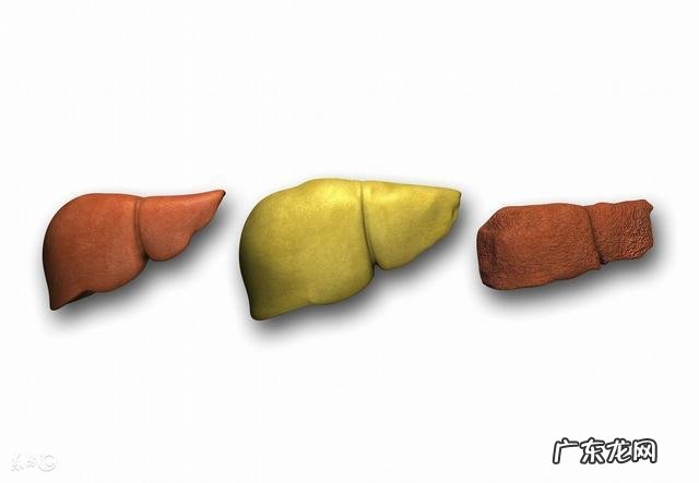 脂肪肝的日常护理方法有哪些