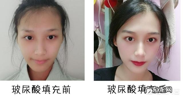 体重一百斤却拥有一百三的大脸是什么样的体验？