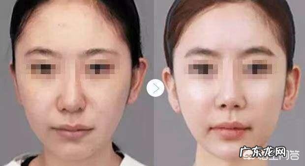 脸比较瘦,两颧骨下面凹陷,有什么办法能让它丰满起来?