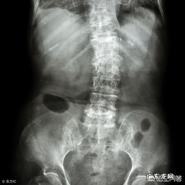 腰疼得厉害,可能是什么原因引起的?该怎么缓解?