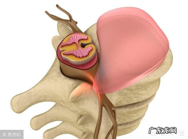 腰疼得厉害,可能是什么原因引起的?该怎么缓解?