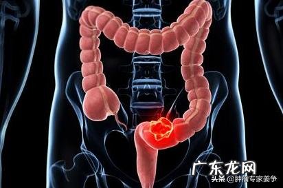 老年人便秘吃益生菌调理有用吗 老年人便秘正常吗?有什么危害?