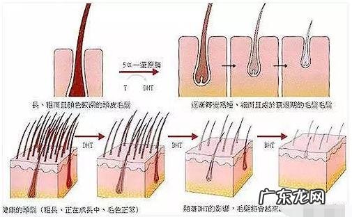 为什么秃顶的大多数都是男性,却从没看过女性秃顶