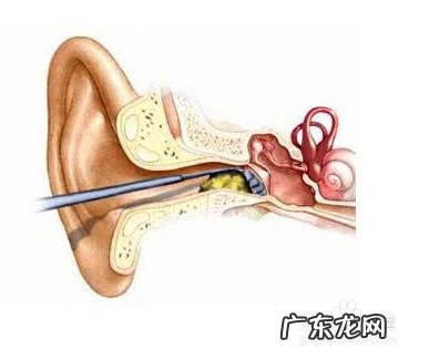 你知道耳屎有什么好处,该怎么清理