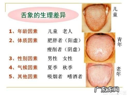 有没有湿气,看舌头就知道,具体怎么看