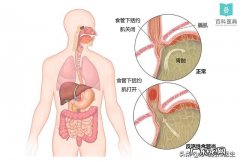 消化科医生都是怎么教胃病患者养胃的