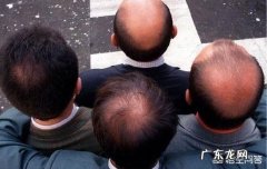 秃顶是男子聪明健康的标志吗